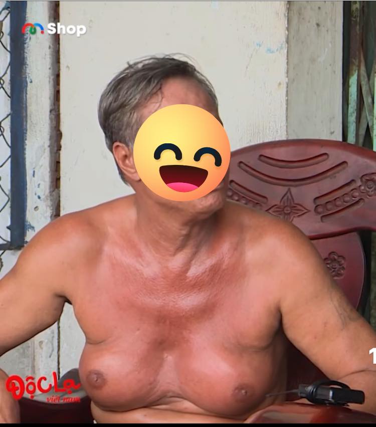 SỰ TÍCH CẶP VÚ SỰ TÍCH CẶP VÚ